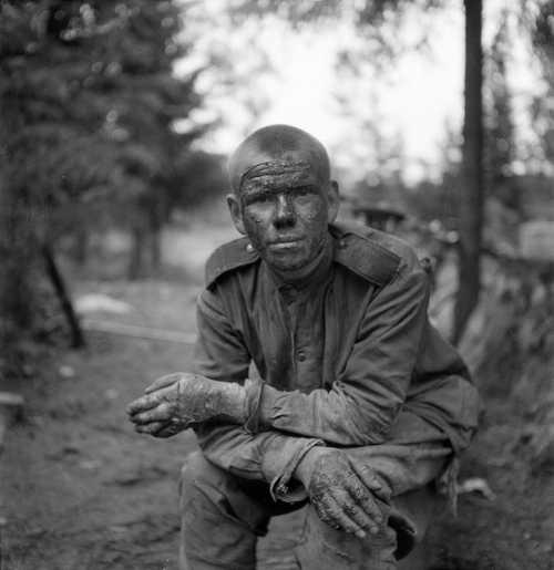 Portrait of a wounded Soviet Army soldier 