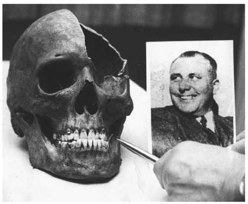 Martin Bormann skull