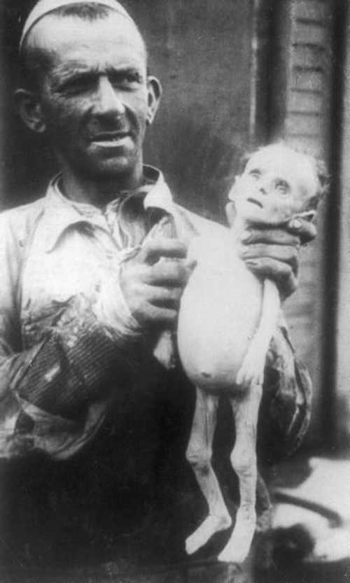Starved child in Warsaw Ghetto