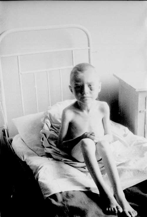 Starving little girl