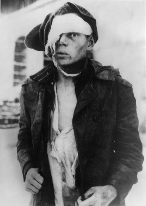 Wounded P.O.W.