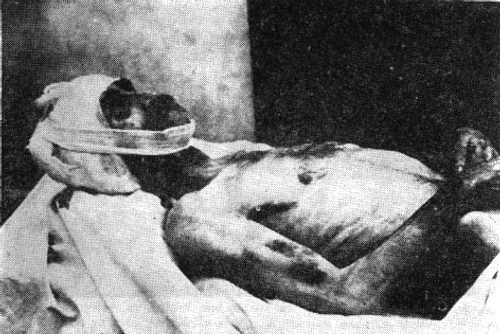 Onet Petre on his hospital bed
