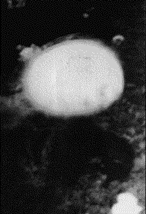 Nagasaki Bomb Exploding, 9 August,1945
