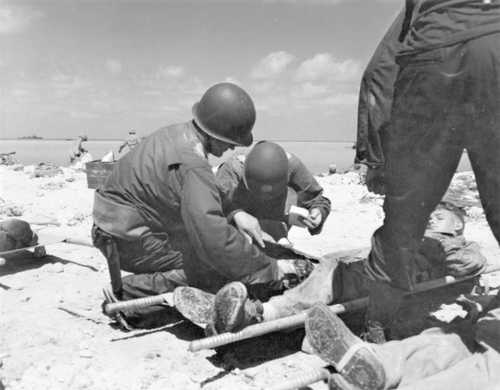 Leg injury in combat
